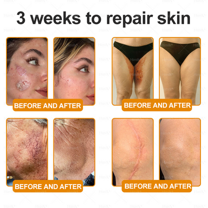 𝑯𝒊𝙢𝒊𝙡𝙠® 𝑩𝐞𝐞 𝑽𝙚𝙣𝙤𝙢 & 𝑻𝙖𝙡𝙡𝙤𝙬 𝑺𝐤𝐢𝐧 𝙍𝐞𝐬𝐭𝐨𝐫𝐚𝐭𝐢𝐨𝐧 𝘾𝐫𝐞𝐚𝐦 –🌸 𝖠𝗇𝗍𝗂-𝖺𝗀𝗂𝗇𝗀,𝖧𝗒𝖽𝗋𝖺𝗍𝗂𝗇𝗀, 𝖲𝗄𝗂𝗇 𝖱𝖾𝗉𝖺𝗂𝗋, 𝖤𝗏𝖾𝗇 𝖳𝗈𝗇𝖾, 𝖠𝖼𝗇𝖾 𝖺𝗇𝖽 𝖣𝖺𝗋𝗄 𝖲𝗉𝗈𝗍 𝖳𝗋𝖾𝖺𝗍𝗆𝖾𝗇𝗍, 𝖶𝖺𝗋𝗍 𝖺𝗇𝖽 𝖬𝗈𝗅𝖾 𝖱𝖾𝗆𝗈𝗏𝖺𝗅, 𝖯𝗌𝗈𝗋𝗂𝖺𝗌𝗂𝗌 𝖱𝖾𝗅𝗂𝖾𝖿