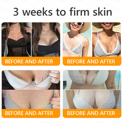 𝑯𝒊𝙢𝒊𝙡𝙠® 𝑩𝐞𝐞 𝑽𝙚𝙣𝙤𝙢 & 𝑻𝙖𝙡𝙡𝙤𝙬 𝑺𝐤𝐢𝐧 𝙍𝐞𝐬𝐭𝐨𝐫𝐚𝐭𝐢𝐨𝐧 𝘾𝐫𝐞𝐚𝐦 –🌸 𝖠𝗇𝗍𝗂-𝖺𝗀𝗂𝗇𝗀,𝖧𝗒𝖽𝗋𝖺𝗍𝗂𝗇𝗀, 𝖲𝗄𝗂𝗇 𝖱𝖾𝗉𝖺𝗂𝗋, 𝖤𝗏𝖾𝗇 𝖳𝗈𝗇𝖾, 𝖠𝖼𝗇𝖾 𝖺𝗇𝖽 𝖣𝖺𝗋𝗄 𝖲𝗉𝗈𝗍 𝖳𝗋𝖾𝖺𝗍𝗆𝖾𝗇𝗍, 𝖶𝖺𝗋𝗍 𝖺𝗇𝖽 𝖬𝗈𝗅𝖾 𝖱𝖾𝗆𝗈𝗏𝖺𝗅, 𝖯𝗌𝗈𝗋𝗂𝖺𝗌𝗂𝗌 𝖱𝖾𝗅𝗂𝖾𝖿