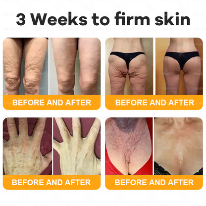 𝑯𝒊𝙢𝒊𝙡𝙠® 𝑩𝐞𝐞 𝑽𝙚𝙣𝙤𝙢 & 𝑻𝙖𝙡𝙡𝙤𝙬 𝑺𝐤𝐢𝐧 𝙍𝐞𝐬𝐭𝐨𝐫𝐚𝐭𝐢𝐨𝐧 𝘾𝐫𝐞𝐚𝐦 –🌸 𝖠𝗇𝗍𝗂-𝖺𝗀𝗂𝗇𝗀,𝖧𝗒𝖽𝗋𝖺𝗍𝗂𝗇𝗀, 𝖲𝗄𝗂𝗇 𝖱𝖾𝗉𝖺𝗂𝗋, 𝖤𝗏𝖾𝗇 𝖳𝗈𝗇𝖾, 𝖠𝖼𝗇𝖾 𝖺𝗇𝖽 𝖣𝖺𝗋𝗄 𝖲𝗉𝗈𝗍 𝖳𝗋𝖾𝖺𝗍𝗆𝖾𝗇𝗍, 𝖶𝖺𝗋𝗍 𝖺𝗇𝖽 𝖬𝗈𝗅𝖾 𝖱𝖾𝗆𝗈𝗏𝖺𝗅, 𝖯𝗌𝗈𝗋𝗂𝖺𝗌𝗂𝗌 𝖱𝖾𝗅𝗂𝖾𝖿