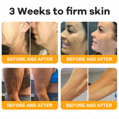 𝑯𝒊𝙢𝒊𝙡𝙠® 𝑩𝐞𝐞 𝑽𝙚𝙣𝙤𝙢 & 𝑻𝙖𝙡𝙡𝙤𝙬 𝑺𝐤𝐢𝐧 𝙍𝐞𝐬𝐭𝐨𝐫𝐚𝐭𝐢𝐨𝐧 𝘾𝐫𝐞𝐚𝐦 –🌸 𝖠𝗇𝗍𝗂-𝖺𝗀𝗂𝗇𝗀,𝖧𝗒𝖽𝗋𝖺𝗍𝗂𝗇𝗀, 𝖲𝗄𝗂𝗇 𝖱𝖾𝗉𝖺𝗂𝗋, 𝖤𝗏𝖾𝗇 𝖳𝗈𝗇𝖾, 𝖠𝖼𝗇𝖾 𝖺𝗇𝖽 𝖣𝖺𝗋𝗄 𝖲𝗉𝗈𝗍 𝖳𝗋𝖾𝖺𝗍𝗆𝖾𝗇𝗍, 𝖶𝖺𝗋𝗍 𝖺𝗇𝖽 𝖬𝗈𝗅𝖾 𝖱𝖾𝗆𝗈𝗏𝖺𝗅, 𝖯𝗌𝗈𝗋𝗂𝖺𝗌𝗂𝗌 𝖱𝖾𝗅𝗂𝖾𝖿